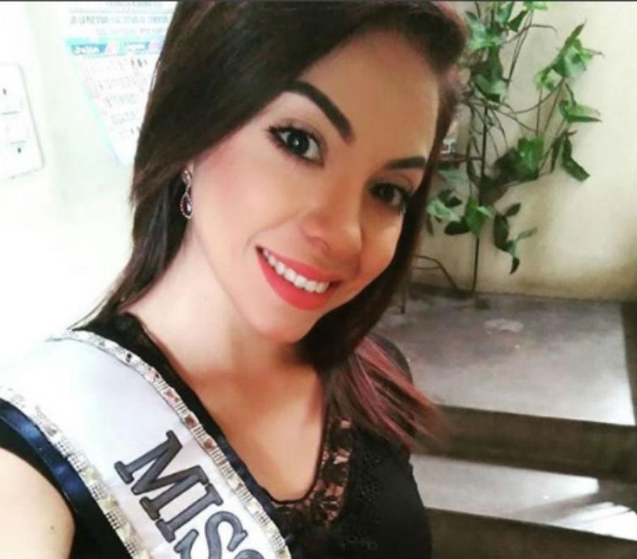 Una Miss peruana está coma tras caer de una escalera (semisquare-x3)