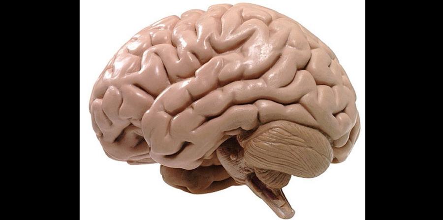 En el estudio se realizaron distintas pruebas: escáner cerebral, test genéticos y análisis del líquido cefalorraquídeo, que rodea y protege el cerebro y la médula. (horizontal-x3)
