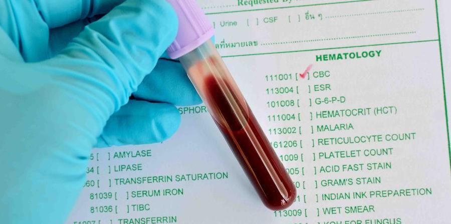 Nuevo tratamiento para los pacientes de leucemia linfática ...