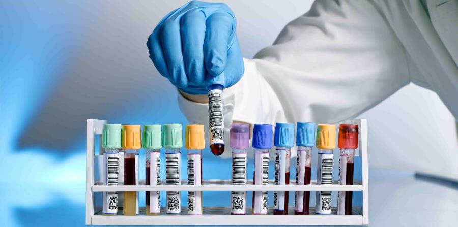 examen de laboratorio pcr que es