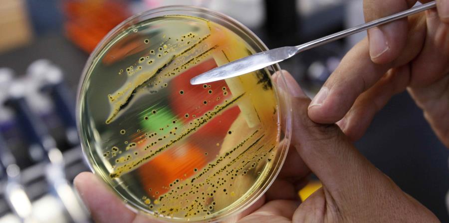 La gente que bebe agua contaminada con la bacteria puede presentar síntomas semejantes a los de una gripe. (horizontal-x3)
