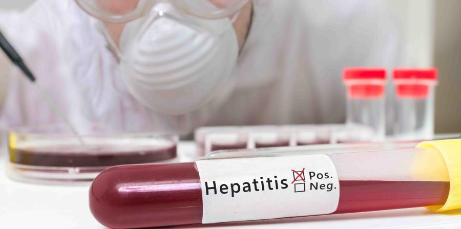 Tengo si como autoinmune saber hepatitis
