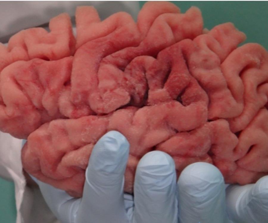 La empresa Lazarus 3D crea prototipos genéricos de distintas partes del cuerpo para el entrenamiento de médicos residentes (semisquare-x3)
