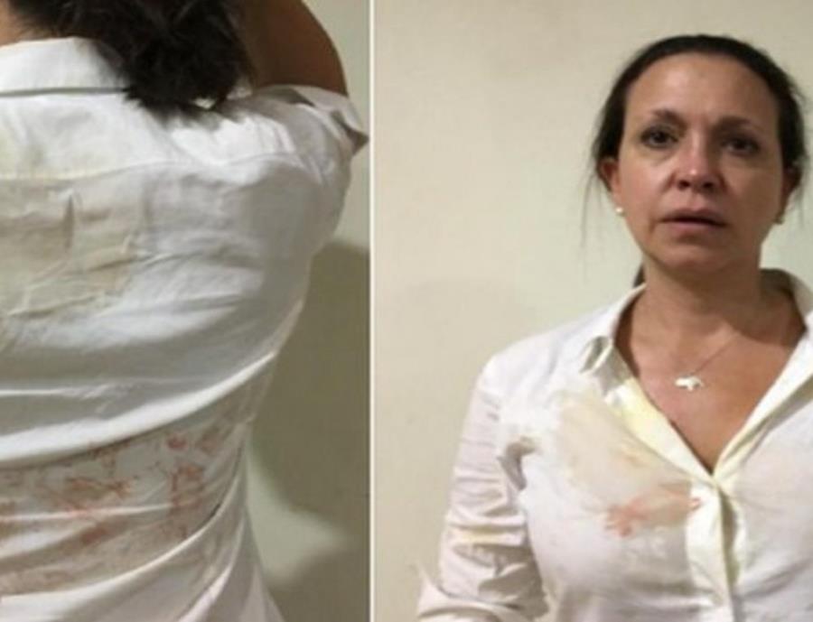 ataque chavista a opositores (semisquare-x3)