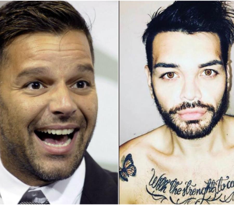 Fran Mariano inició su serie de cirugías en 2010 las cuales suman hasta el momento unas 27. (GDA/ El Comercio) (semisquare-x3)