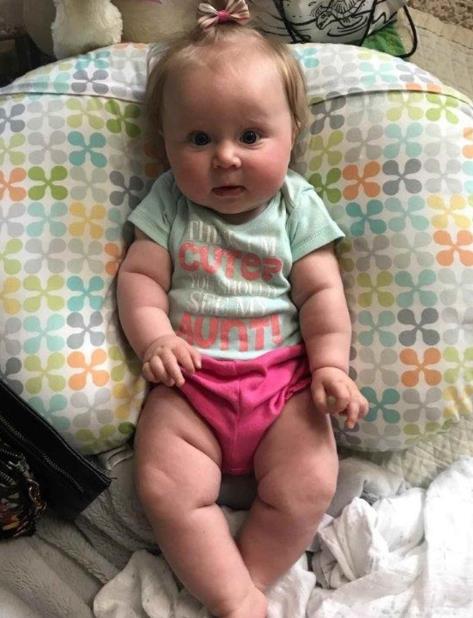 La pequeña Emma Grace Kennedy. (AP) (vertical-x1)